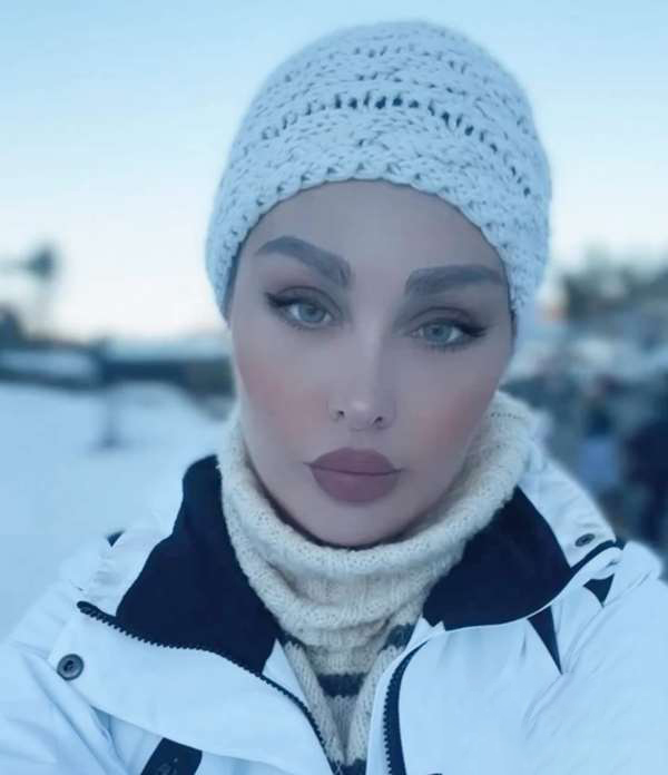 طلا گلزار