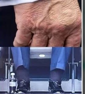 فقع