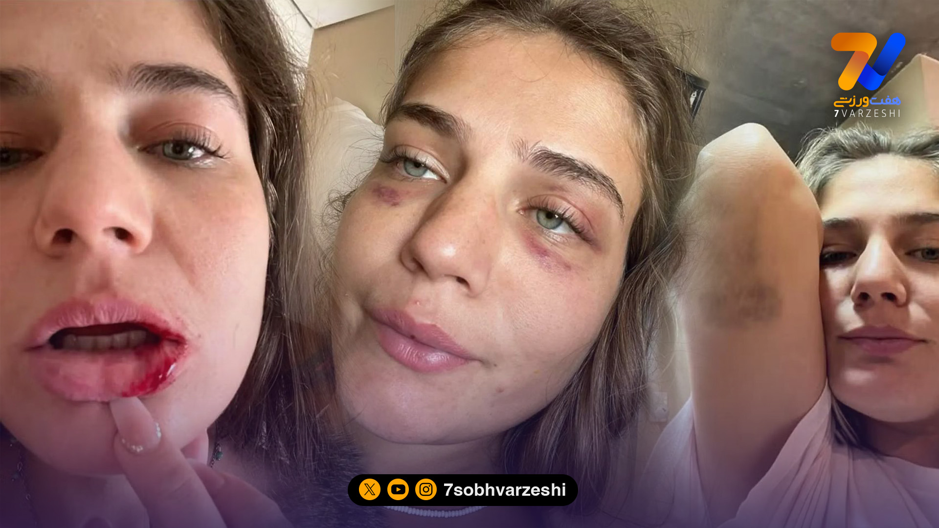 ادعای جنجالی یک مدل برزیلی: فوتبالیست معروف من را شکنجه و زندانی کرد!