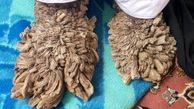 روایتی از زندگی عجیب و دردناک مرد درختی ایران (ویدیو)