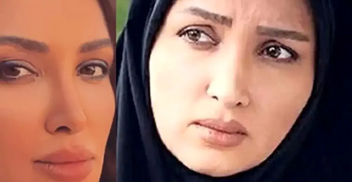 آلبوم عروسی روناک یونسی