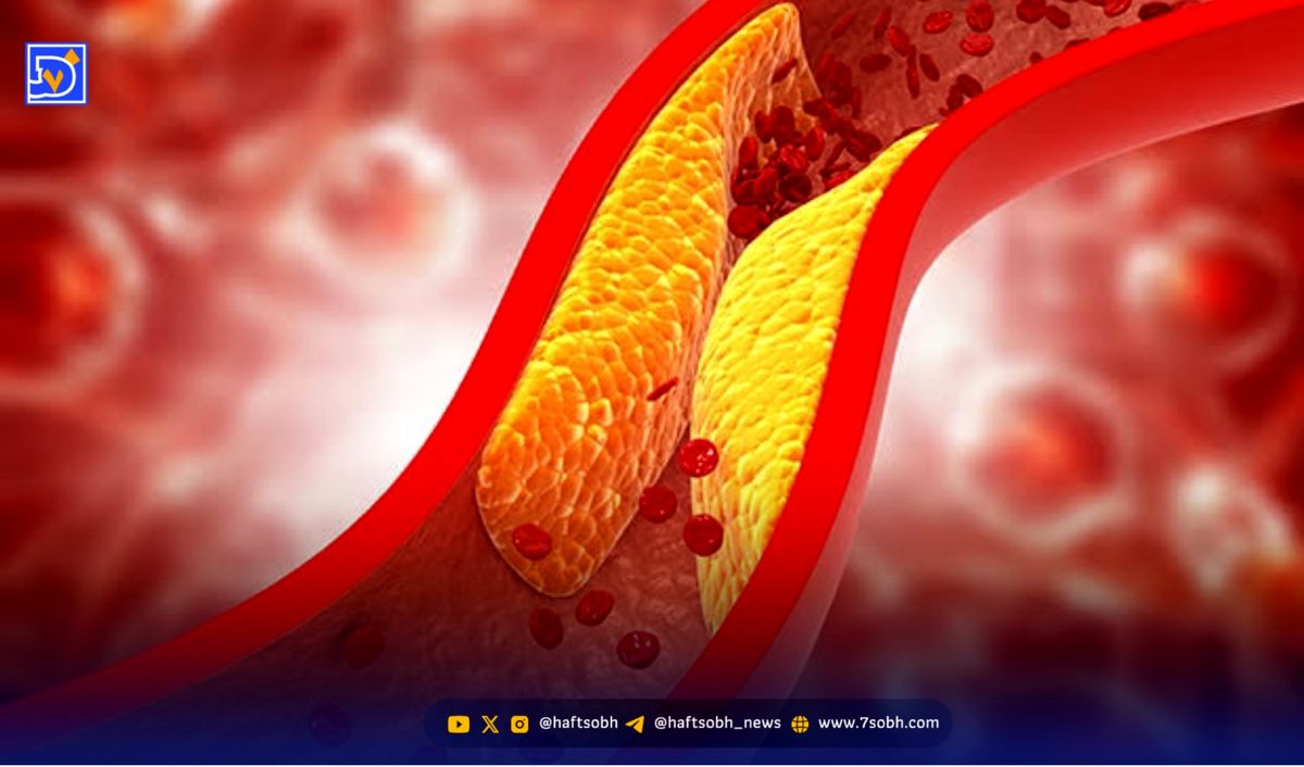 این غذاها دشمن کلسترول بدن هستند