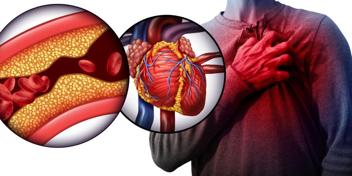 یک روش ساده برای کاهش کلسترول خون