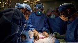 دست پزشک ایرانی در پیوند کلیه خوک به یک زن