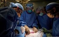 دست پزشک ایرانی در پیوند کلیه خوک به یک زن