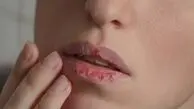 خشکی مداوم دهان چه هشداری می‌دهد؟ علت‌هایی که باید بدانید