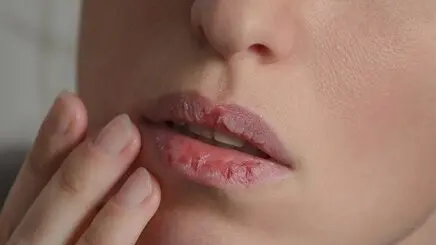 خشکی مداوم دهان چه هشداری می‌دهد؟ علت‌هایی که باید بدانید