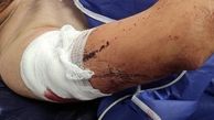 تکرار فاجعه زورگیری از دانشجویان این بار در شهر گرگان