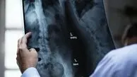  هوش مصنوعی در خدمت تشخیص ناهنجاری‌های جنین/تصویربرداری پزشکی در مسیر تحول 