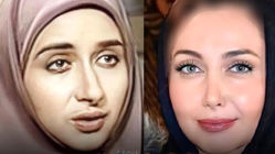 تغییر چشمگیر هنرمندان قبل و بعد از عمل زیبایی + ویدئو
