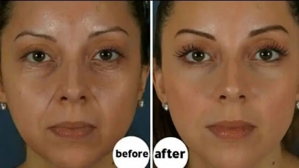 جالب‌ترین تکنیک برای فرار از بوتاکس توسط زنان ژاپنی (ویدیو)