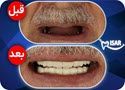بیتوته