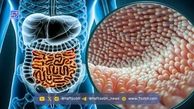 اگر التهاب روده دارید، این میوه‌ها را بخورید