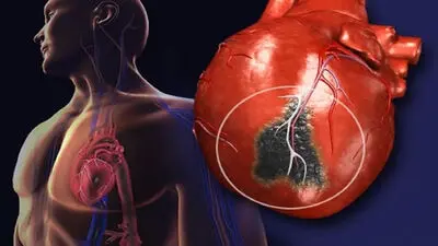چرا هنگام بلند شدن از جا سرگیجه می‌گیریم؟ علت‌ها و علائم هشداردهنده