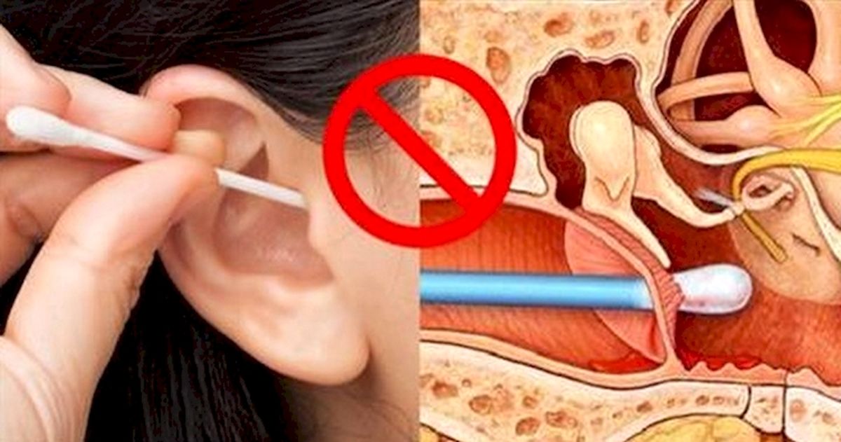 آیا می دانستید گوشپاکنهای بازاری موجب آسیب به گوش می شوند؟