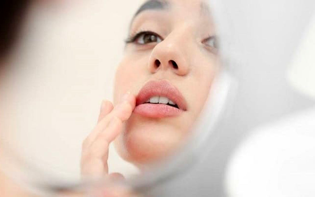 با این خوراکی‌ها‌‌ تبخال را درمان‌ کنید