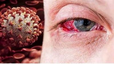 مطالعه در تاریکی چشم را ضعیف می‌کند؟
