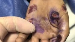 ماجرای مرگ تلخ کودک 4 ساله / کودک آزاری منجر به فوت شد