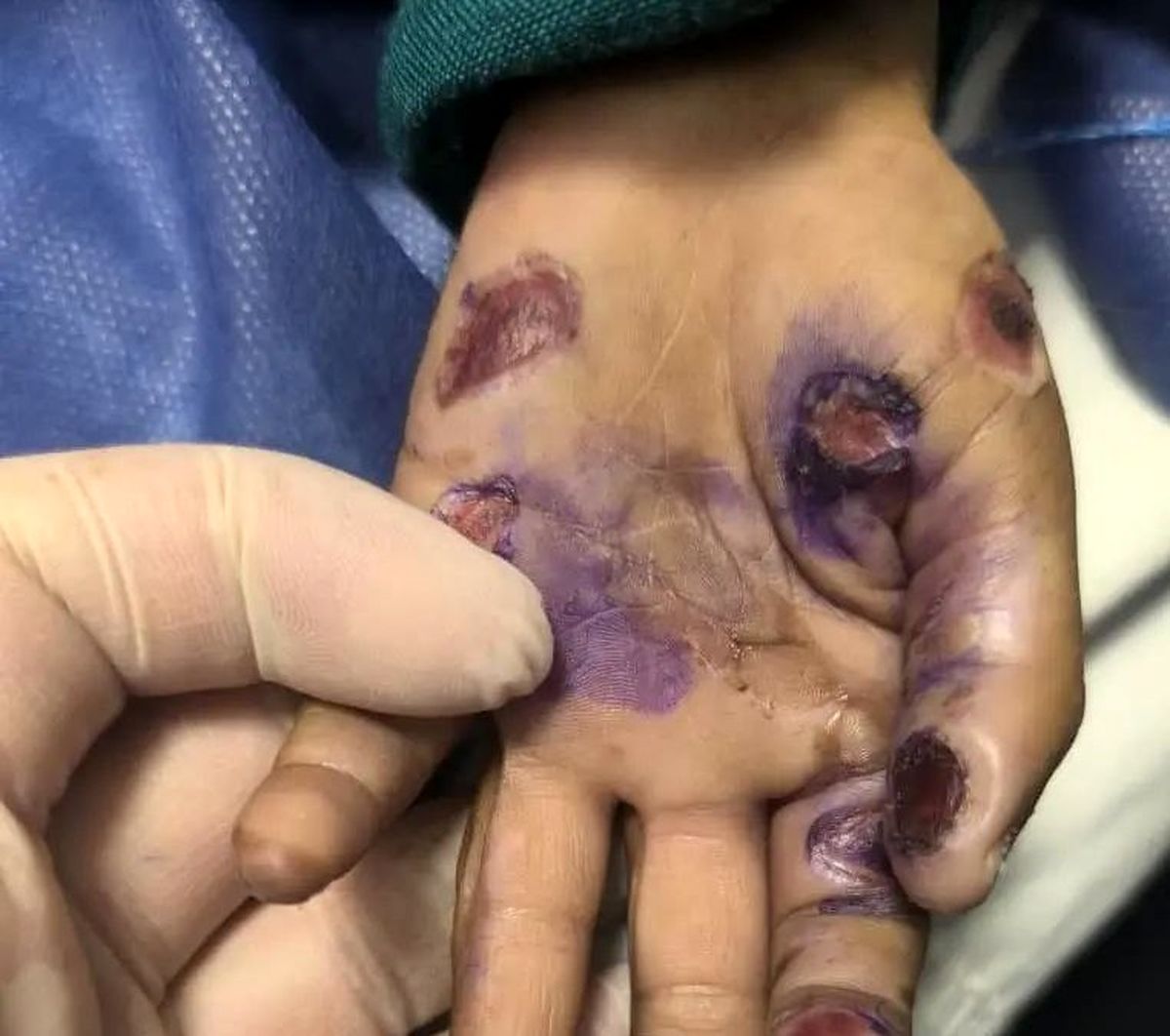 ماجرای مرگ تلخ کودک 4 ساله / کودک آزاری منجر به فوت شد