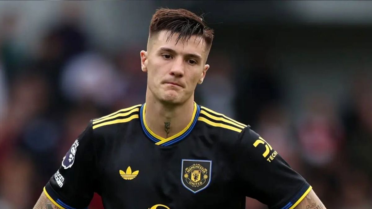 خبر بد برای منچستریونایتد / مصدومیت ششکو جدی است