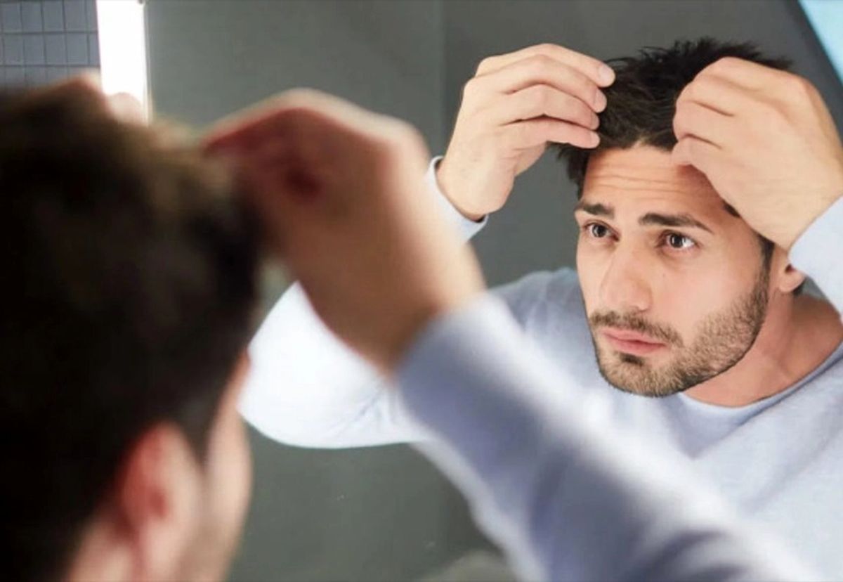 دلایل اصلی شورهسر؛ چرا پوست سرتون میریزه؟