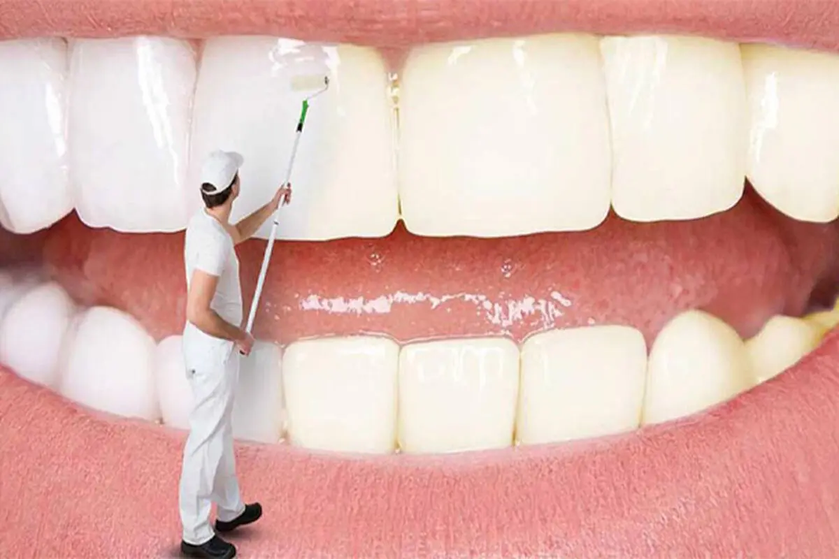 روش‌های خانگی سفید کردن دندان؛ چه راهکارهایی واقعاً مؤثرند؟