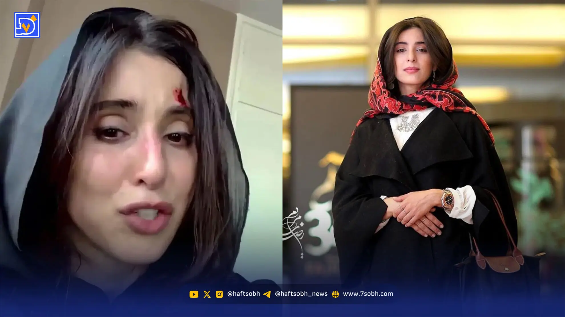 بیوگرافی آناهیتا افشار + ماجرای ویدیو چیست؟