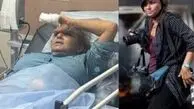  عکاس واشنگتن پست پس از حمله شهرک‌نشینان در شرق رام‌الله زخمی شد 