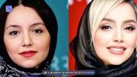 برسی قبل و بعد چهره نازنین بیاتی «مریم سریال تاسیان» از گذشته تا امروز، ستاره محبوب چه جراحی‌هایی انجام داده؟