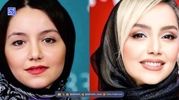 برسی قبل و بعد چهره نازنین بیاتی «مریم سریال تاسیان» از گذشته تا امروز، ستاره محبوب چه جراحی‌هایی انجام داده؟