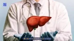 خوراکی های قاتل کبد چرب را بشناسید