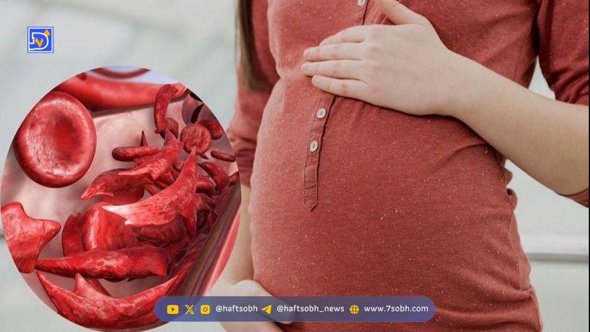 کمبود آهن در بارداری سلامت مادر و نوزاد را تهدید میکند؟