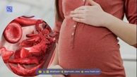 کمبود آهن در بارداری سلامت مادر و نوزاد را تهدید می‌کند؟