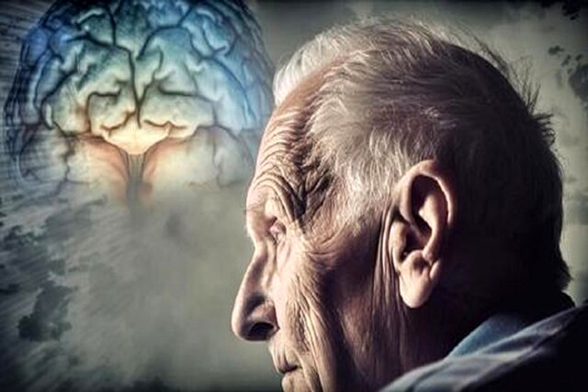 استرالیا اولین داروی درمان بیماری آلزایمر را تایید کرد