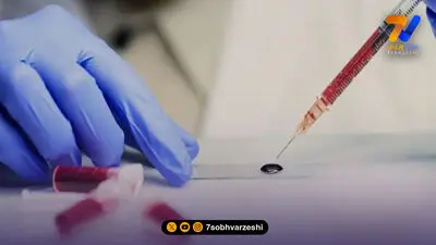 تور دو فرانس زیر سایه حاشیه؛ بیدارباش ساعت ۵ صبح برای تست دوپینگ