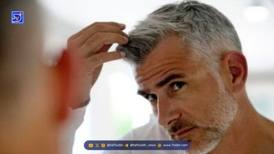 ۳ خوراکی که ریزش مو را تشدید می‌کنند؛ از نوشابه تا الکل