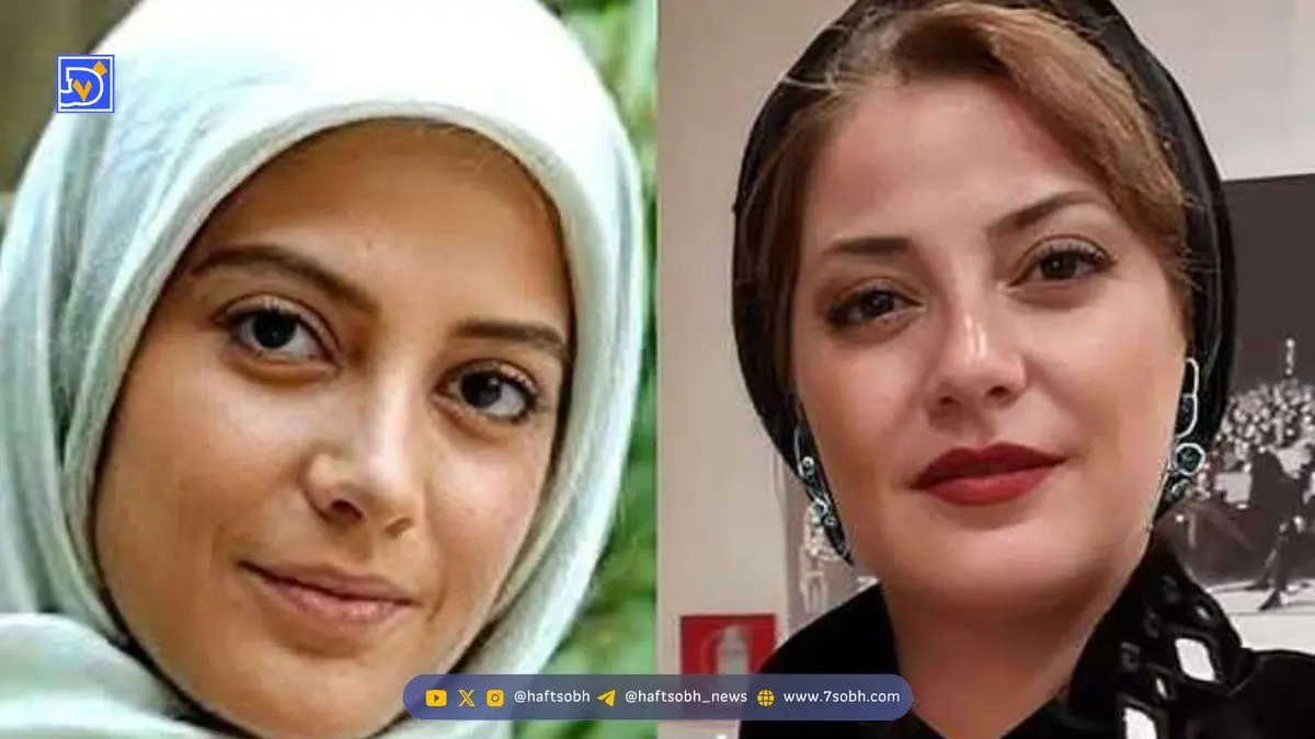  عکس روز| نمایی از تغییر چهره فوق زیبای طناز طباطبایی / خانم بازیگر خوش قدو بالا و خوش استایل خارج از سینما و سریال ... 