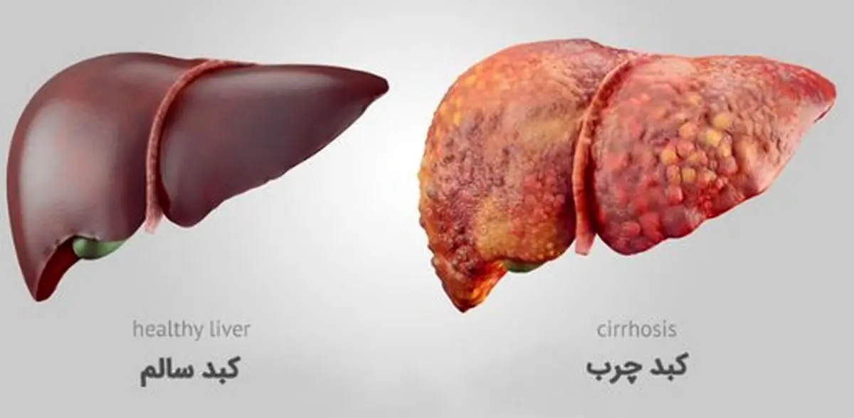 این بیماری را جدی بگیرید