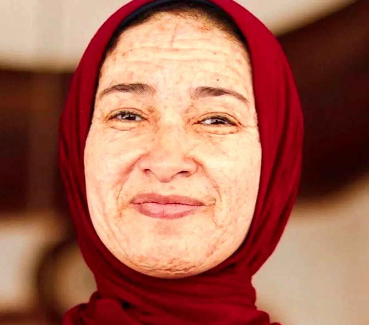 پیرزنی که فقط ۲۲ سال دارد!