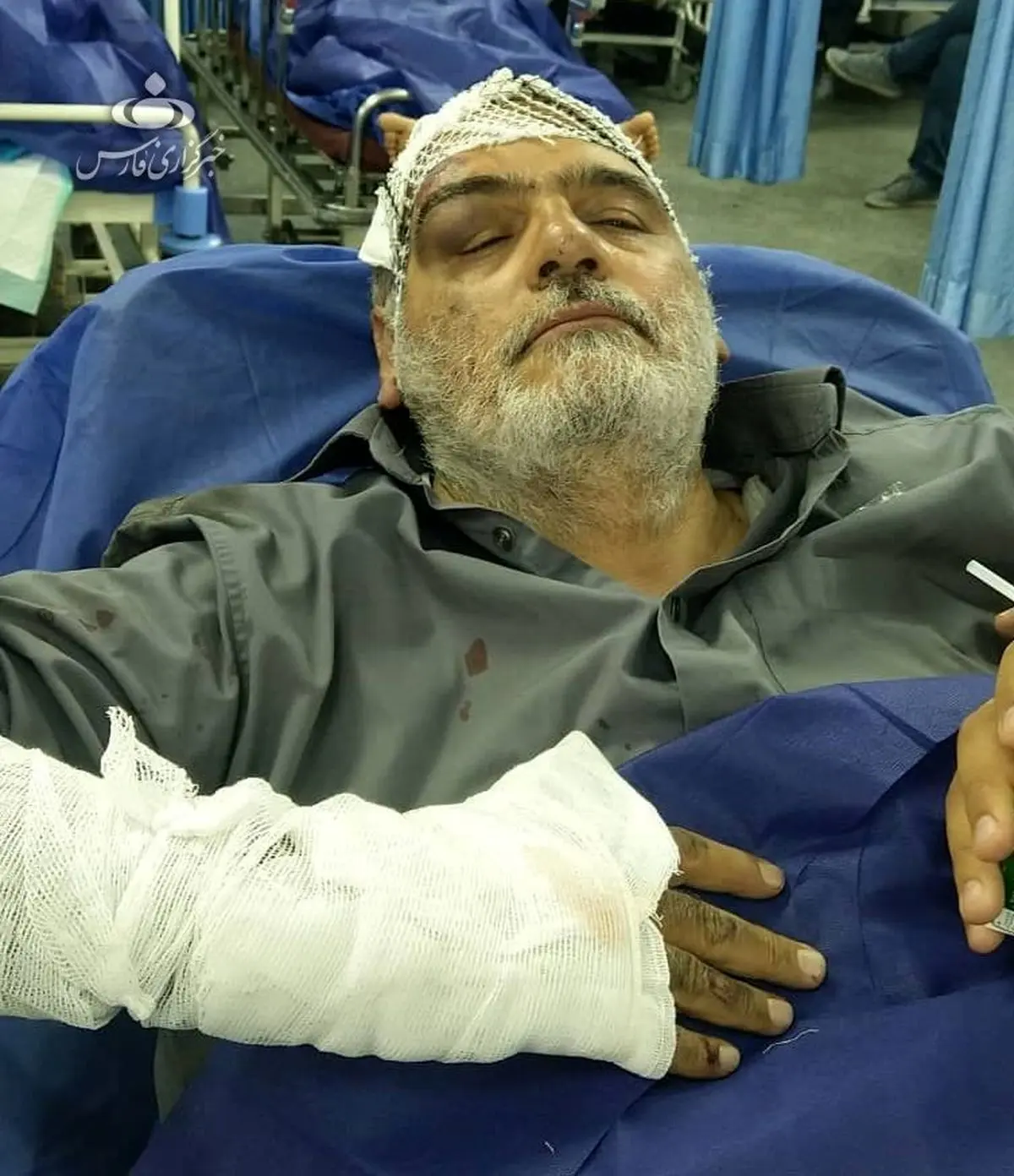 حسین‌الله کرم دچار سانحه رانندگی شد/ عکس