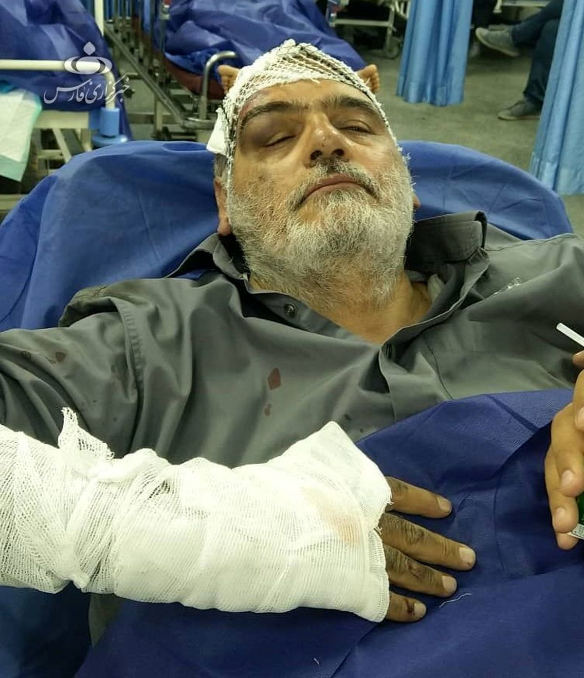 حسینالله کرم دچار سانحه رانندگی شد/ عکس
