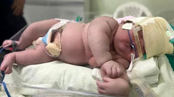 سنگین‌ترین نوزاد کشور متولد شد