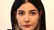 بیوگرافی و حواشی روفیا محضری / ماجرای صورت اسید پاشی شده + عکس ها