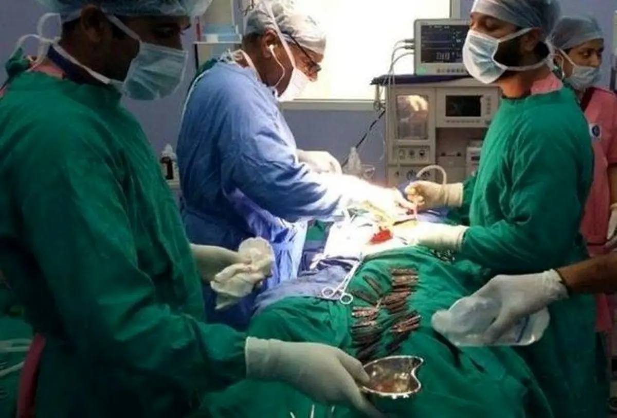 تماشا کنید؛ خارج کردن ۴۰ چاقو در معده بیمار