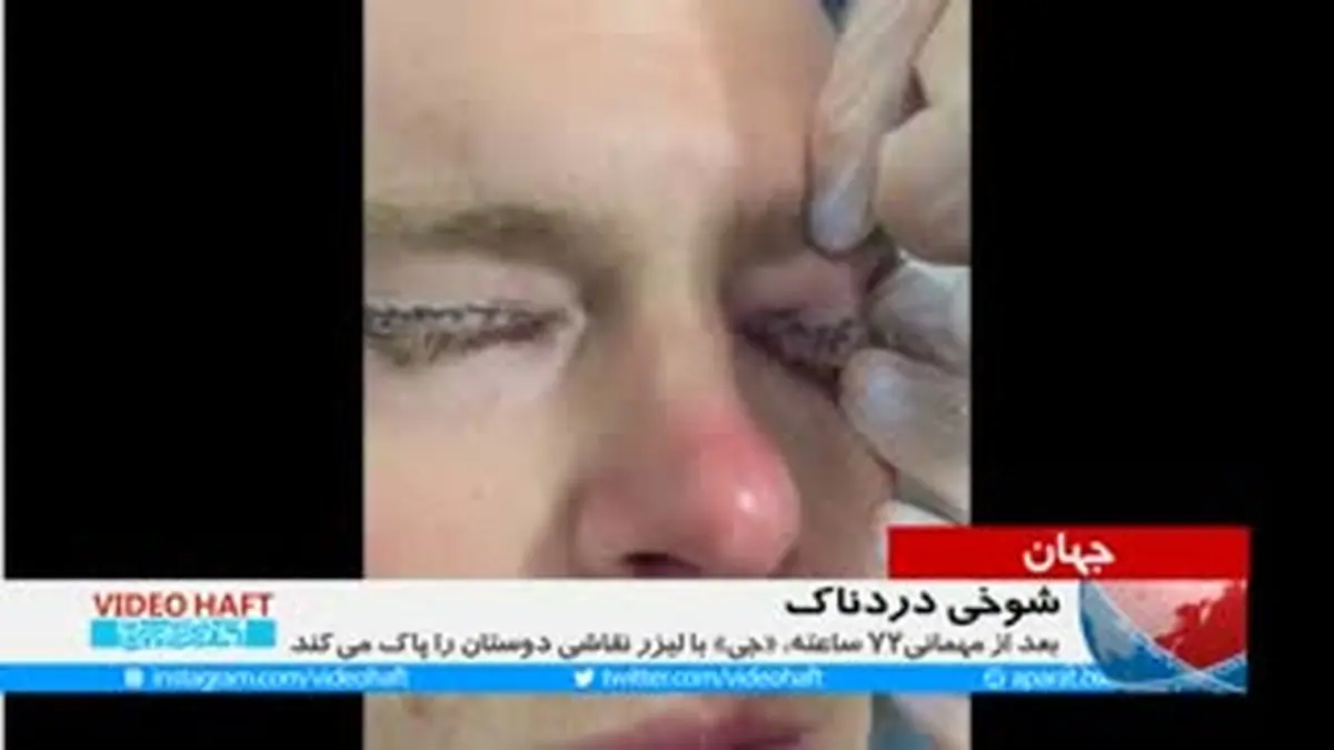 ویدیو هفت|تتو پشت پلک