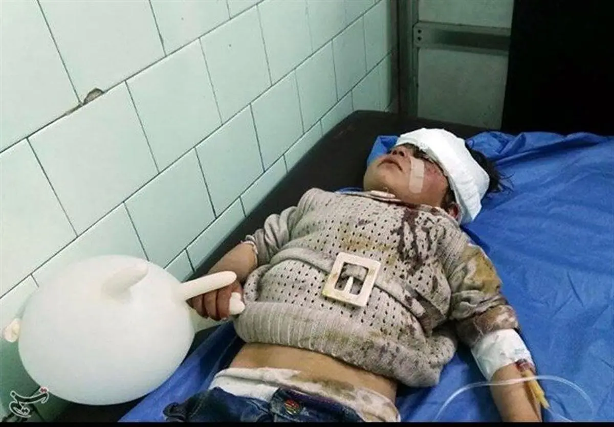 ۶۸ کودک؛ قربانی انفجار در حلب