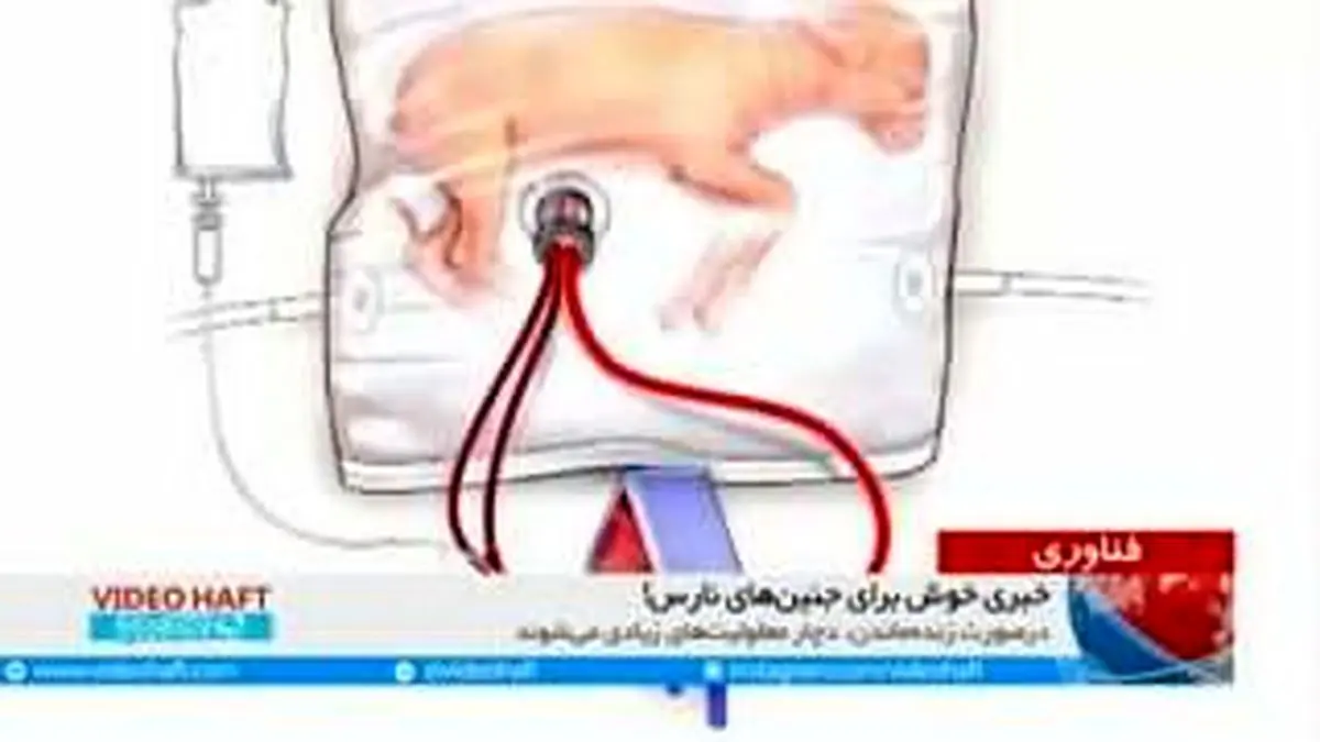 ویدیو هفت|خبری خوش درباره نوزادان زودرس