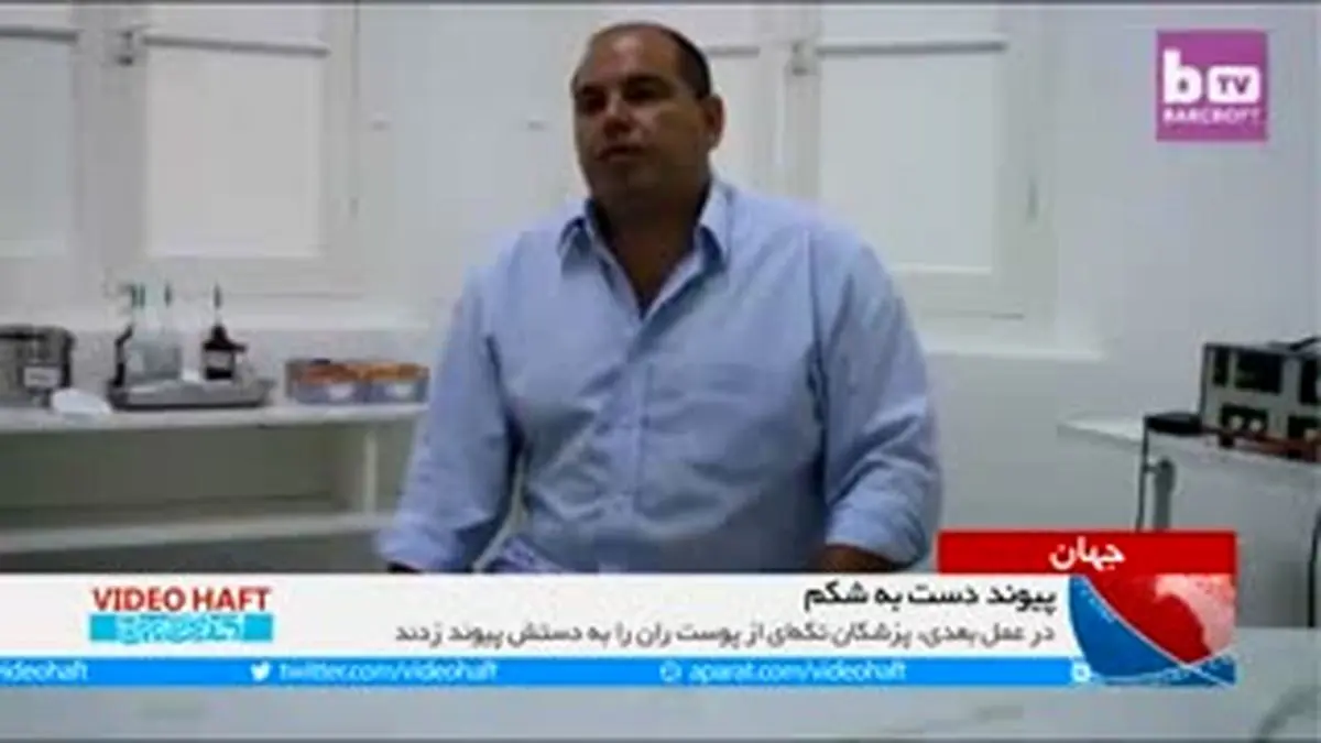 ویدیو هفت|پیوند دست بدون انگشت به شکم!
