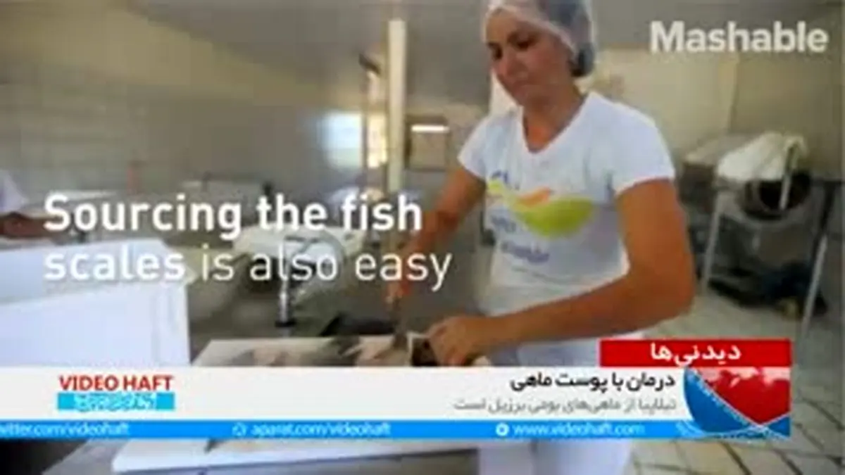 ویدیو هفت |درمان سوختگی با پوست ماهی