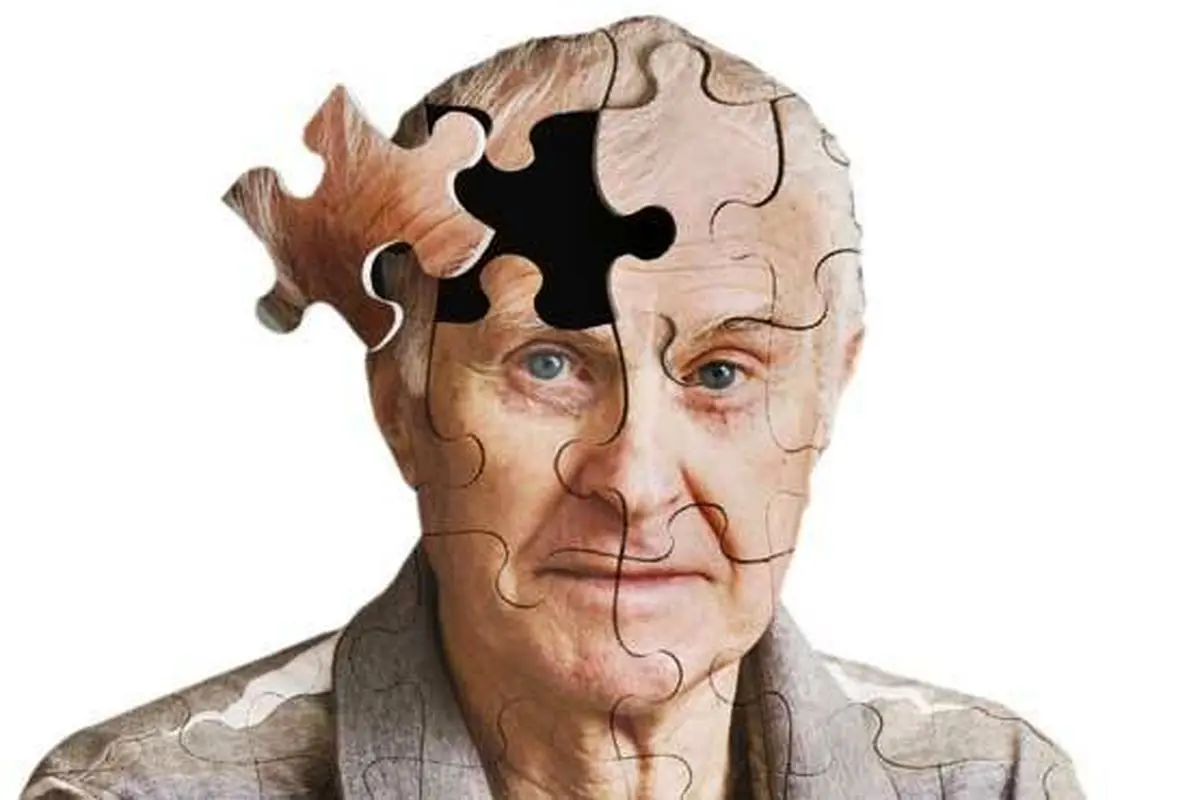 افزایش خطر ابتلا به آلزایمر با شب بیداری